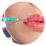 Esthetic medicine Juventas - Fillers, injections : Hyaluronic acid, dark circles, wrinkles, lips, non-surgical treatments, BOTOX®, rhinoplastie...