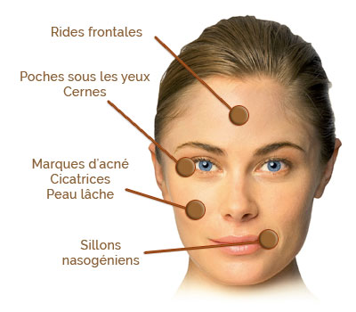 Médecine esthétique Juventas - Comblement, injections : acide hyaluronique, cernes, rides, lèvres, soins non chirurgicaux, BOTOX®, rhinoplastie...