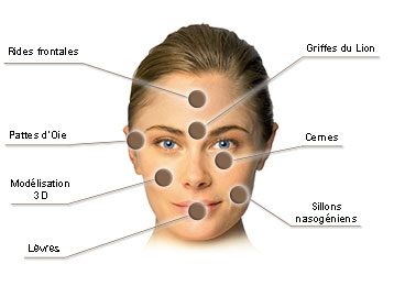 Médecine esthétique Juventas - Comblement, injections : acide hyaluronique, cernes, rides, lèvres, soins non chirurgicaux, BOTOX®, rhinoplastie...