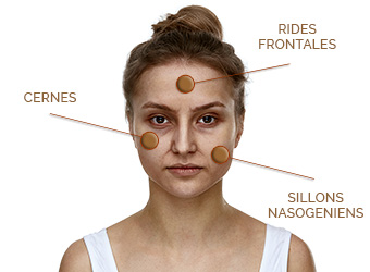 Médecine esthétique Juventas - Comblement, injections : acide hyaluronique, cernes, rides, lèvres, soins non chirurgicaux, BOTOX®, rhinoplastie...