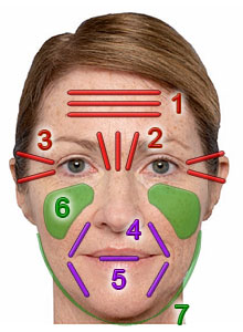 Médecine esthétique Juventas - Comblement, injections : acide hyaluronique, cernes, rides, lèvres, soins non chirurgicaux, BOTOX®, rhinoplastie...